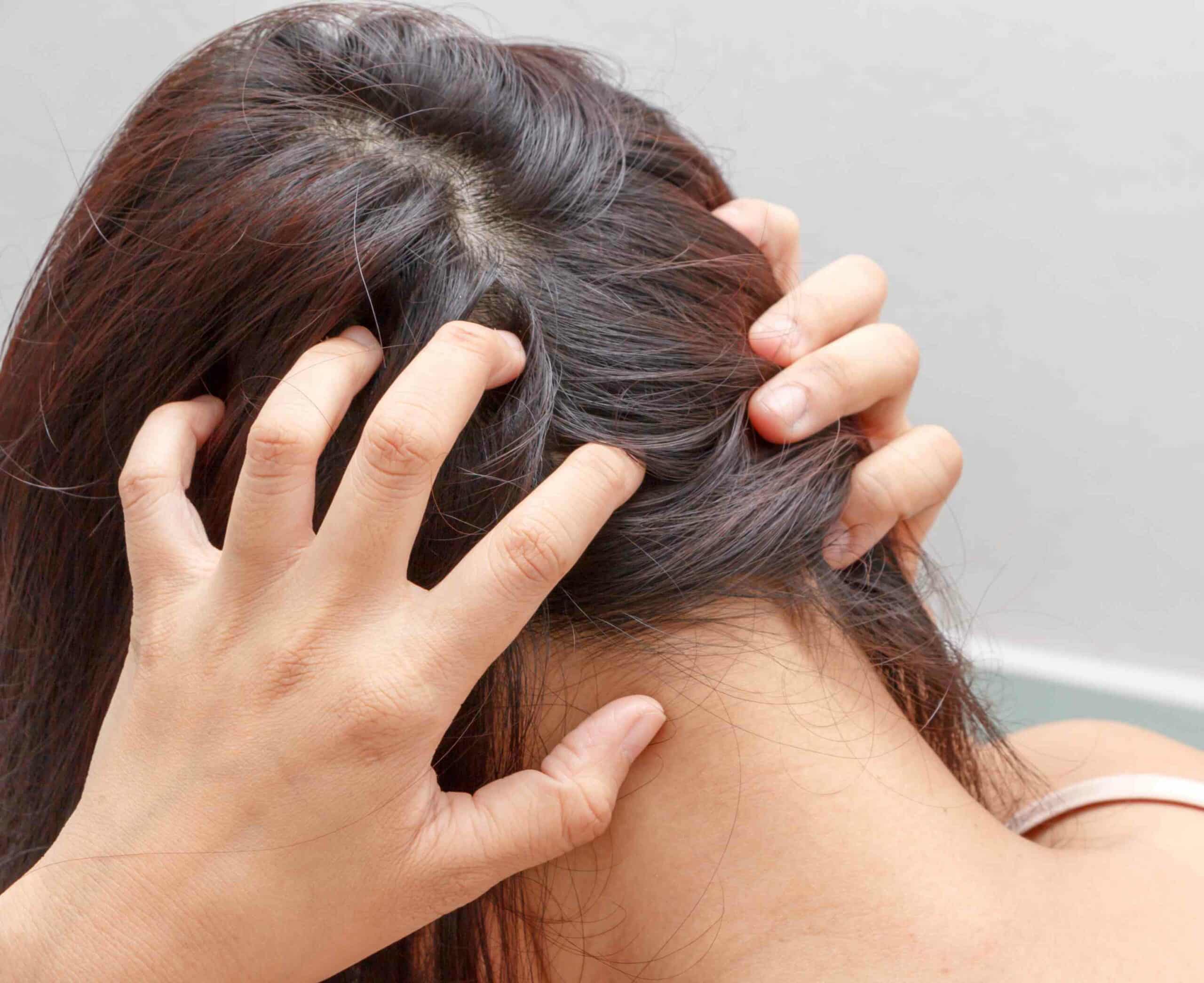 Comment arrêter une chute de cheveux liée à un stress chronique ? | Maison Albanéa | Aubagne